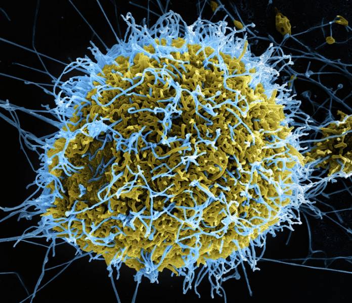 Эбола вируси. Фото: Flickr