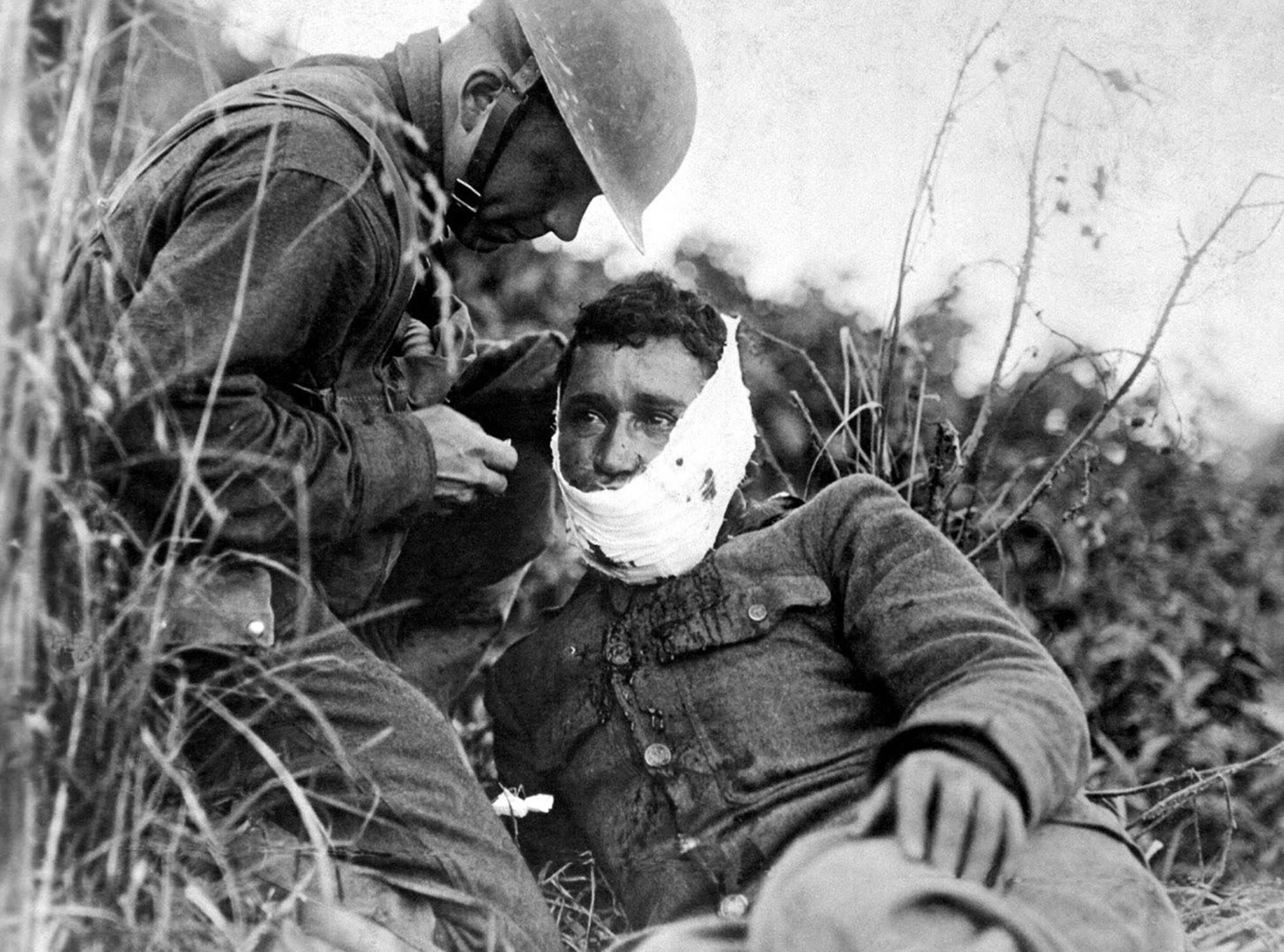 Раненые солдаты первой мировой войны
