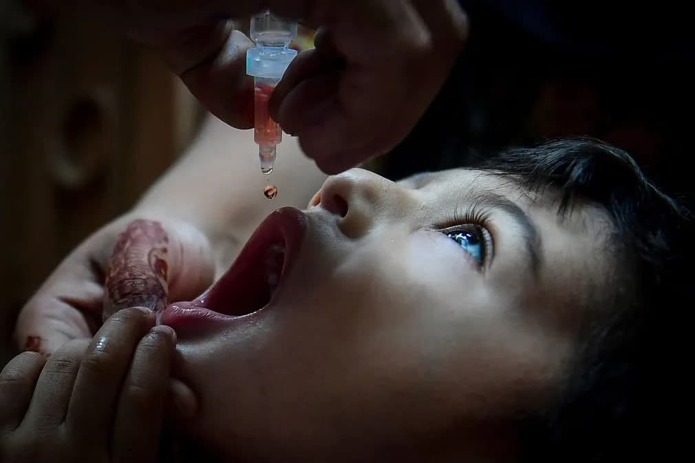 Karachi shahrida tibbiyot xodimi poliomiyelitga qarshi vaksina tomchisini bola og‘ziga tomizmoqda.