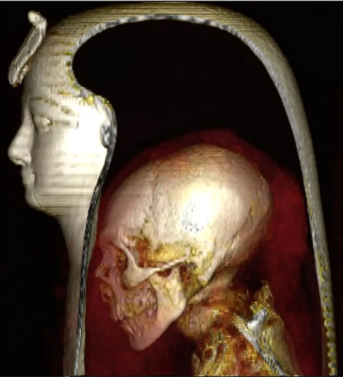 Компьютер томографияси ёрдамида визуализация қилинган бинт чойшаблар ва ниқоб остидаги Аменхотеп I нинг боши