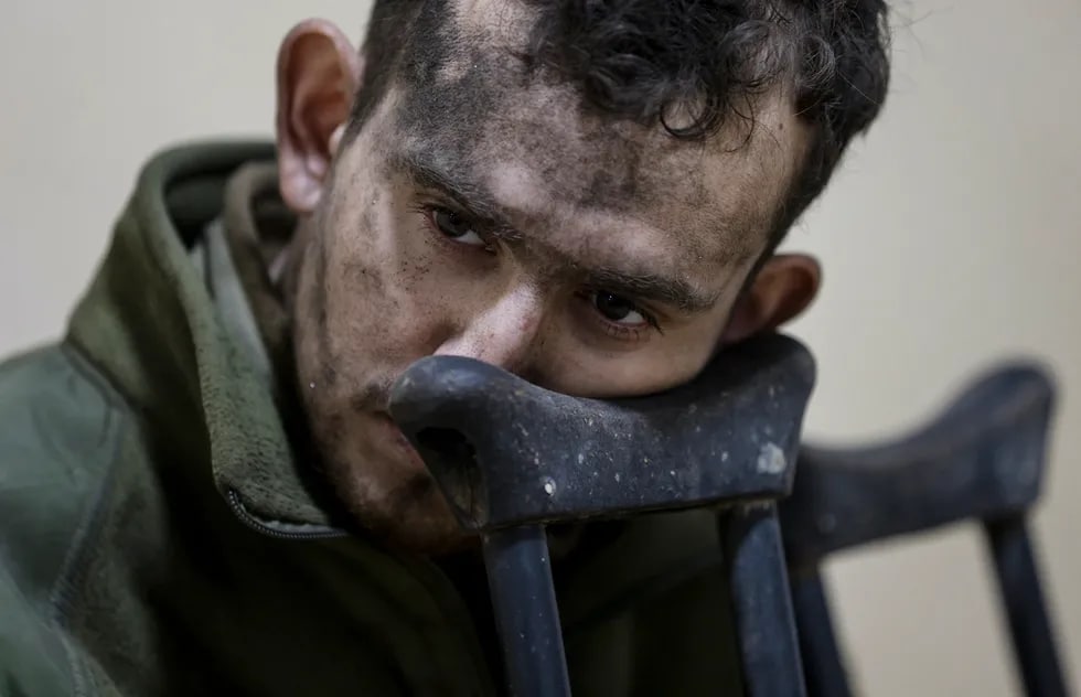 O‘zini o‘zi respublika deb e’lon qilgan Donetskdagi kasalxonada Ukraina Qurolli kuchlarining yarador askari.