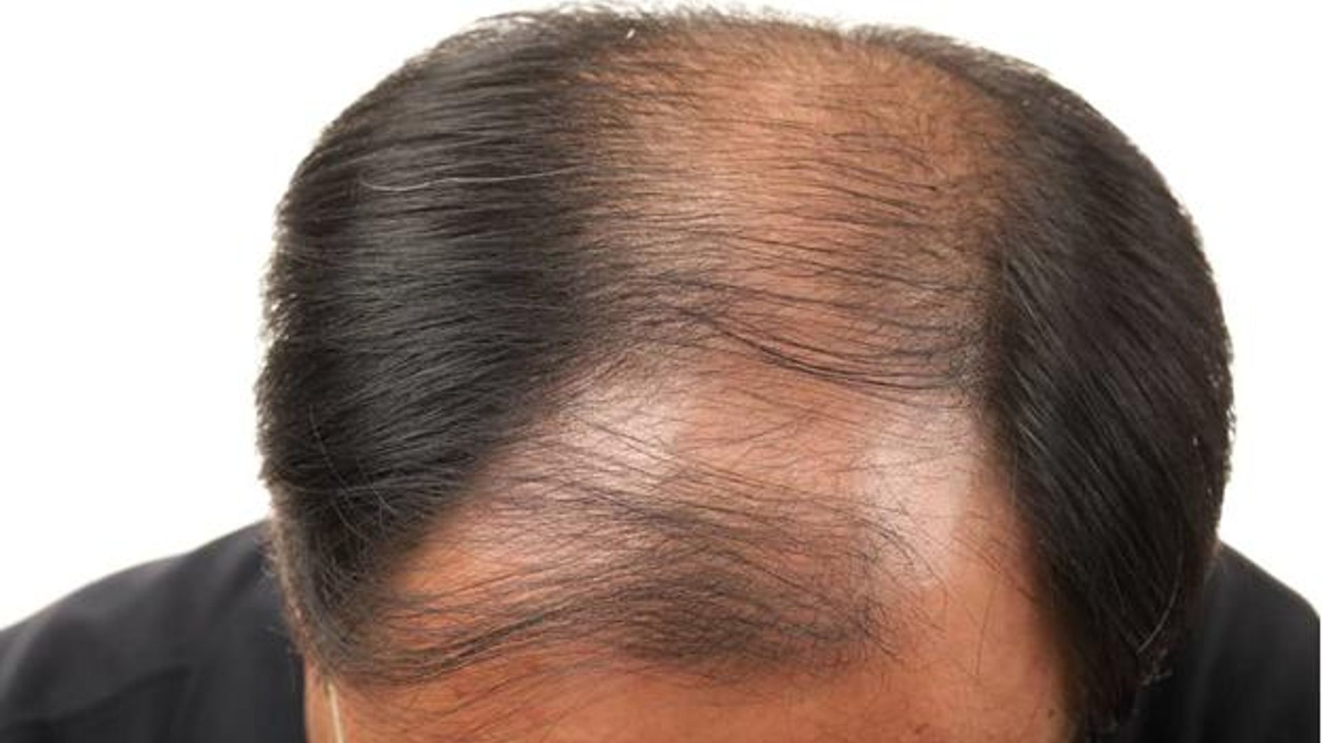 Qizil sochli kaltakning erkagi