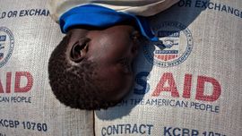 Халқаро ёрдам қисқариши оқибатида 2025-йилда беш ёшгача бўлган 4,8 миллион бола вафот этди