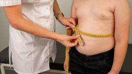 Ўзбекистонда миллионлаб болалар семизлик ва ортиқча вазндан азият чекмоқда — тадқиқот 