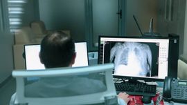 COVID-19 нинг янги “Сикада” штамми Ўзбекистонга кириб келиш эҳтимоли борми? Мутахассис жавоб берди