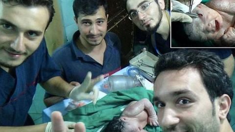 Suriyada boshida raketa parchasi bo‘lgan qizaloq dunyoga keldi