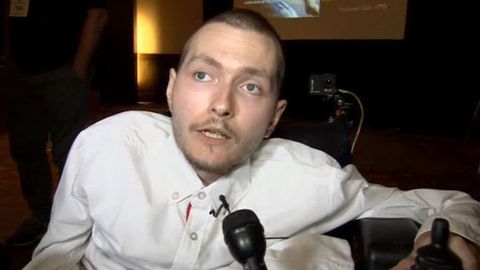 Inson boshini ko‘chirib o‘tkazish bo‘yicha dunyodagi birinchi operatsiya o‘tkaziladigan sana ma’lum qilindi