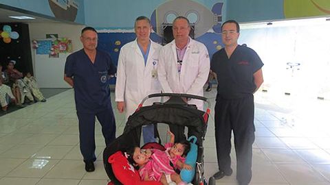 Gvatemalada shifokorlar Siam egizaklarini muvaffaqiyatli ajratishga erishdi