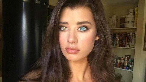 Ikki xil rangdagi ko‘z sohibasi bo‘lgan model internetni hayratda qoldirdi