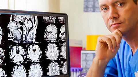 Aqli zaif kishilar soni 2050-yilga kelib, ikki marta ko‘payadi