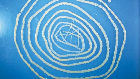 Xitoylik shifokorlar qornidagi doimiy og‘riqdan shikoyat qilgan mijozda  6 metrli gijja borligini aniqladi 