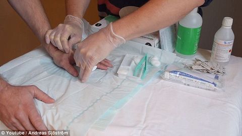 Gollandiyalik sayohatchi qo‘l terisi ostiga NFC chipini joylashtirdi