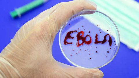 Gvineyada Ebola virusidan to‘rt kishi halok bo‘ldi