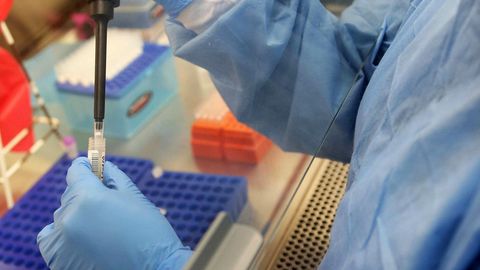 Nikaraguada Zika virusi bilan kasallanish holatlari 126 taga yetdi