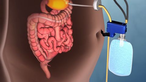 АҚШда тезкорлик билан озиш усули ўйлаб топилди