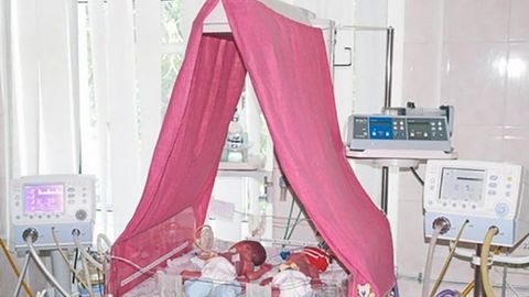 Odessalik ayol besh egizni dunyoga keltirdi