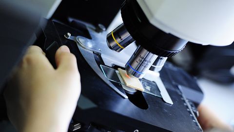 Исроиллик олимлар тери ҳужайраларидан юрак тўқималарини яратди