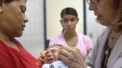 Ispaniyada Zika virusi bilan bog‘liq mikrotsefaliyaga chalingan ilk chaqaloq tug‘ildi