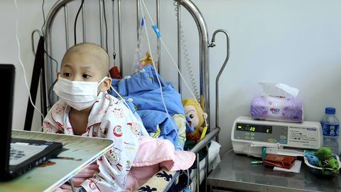 Daniya va AQSh olimlari: C vitamini oqqon kasalligini davolashda yordam berishi mumkin