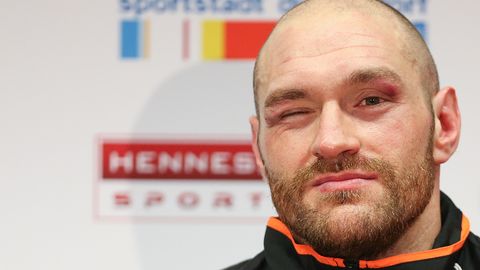 OAV: Britaniyalik bokschi Tayson Fyurining ikkinchi doping-testida ham kokain izlari aniqlandi