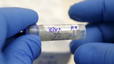 Tailandda barcha homilador ayollar Zika virusi mavjudligi yuzasidan tekshiriladi