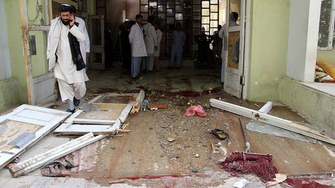 Hamid Karzayning ukasi Qandahordagi yaralanishdan so‘ng olamdan o‘tdi