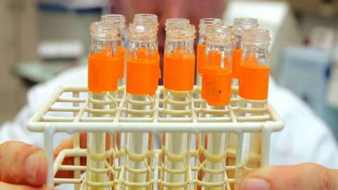 Organizmidan doping chiqqan eronlik to‘rt sportchi tirikchiligi bilan to‘rt yilga xayrlashdi