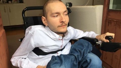 Italiyalik neyrojarroh rossiyalik dasturchining boshini ko‘chirib o‘tkazishdan bosh tortdi