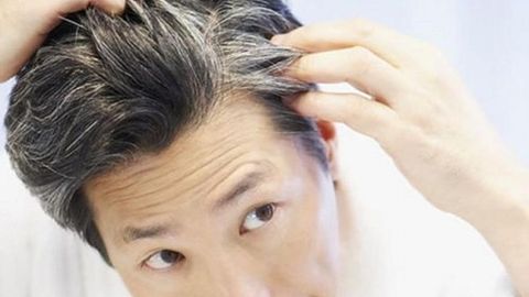 Сочлар стресс натижасида оқариши мумкинми?