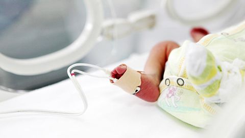 Hindistonda o‘lik deb hisoblangan chaqaloqqa kuydirish marosimi oldidan jon kirdi