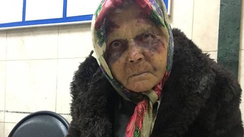 O‘zbekistonning Moskvadagi elchixonasi kaltaklangan o‘zbekistonlik ayolga yordam beradi