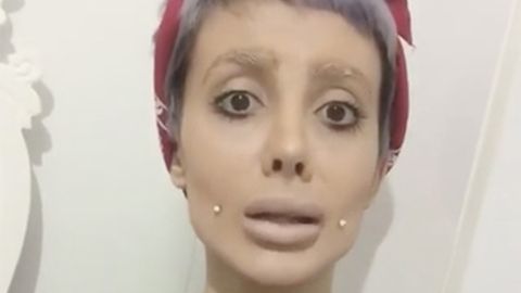 «Эронлик Анжелина Жоли» қўрқинчли ташқи кўриниши сирини очди