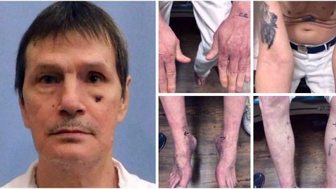 AQShda mahbusning vena tomiri topilmagani sabab qatl kechiktirildi