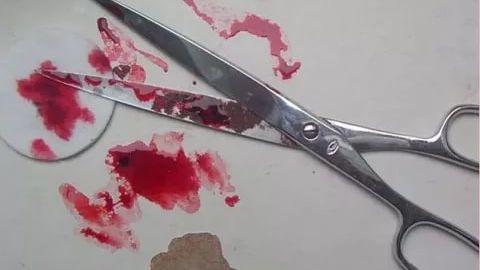 Namanganda ayolini qaychi bilan jarohatlagan er qo‘lga olindi