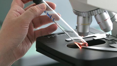 O‘zbekistondan keltirilgan viruslar Rossiyada qizamiq bilan kasallanish ko‘payishiga sababchi bo‘ldi