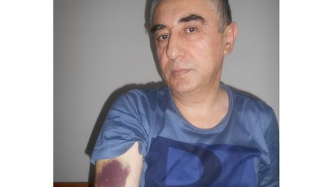 Toshkent shahar IIBB: biznesmenning qiynoqqa solingani haqidagi xabarlarni sud tekshiradi