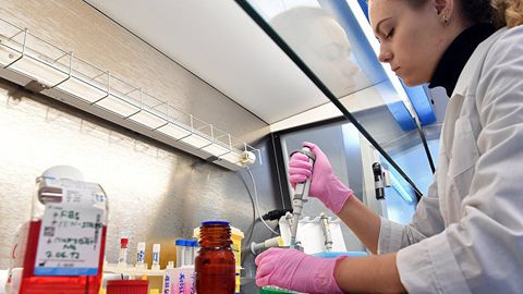 Tuberkulyoz dunyodagi eng ko‘p o‘lim keltiruvchi infeksiya deb topildi