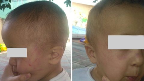 Toshkentdagi xususiy bolalar bog‘chasi mudirasi 1 yashar bolaning yuziga urdi