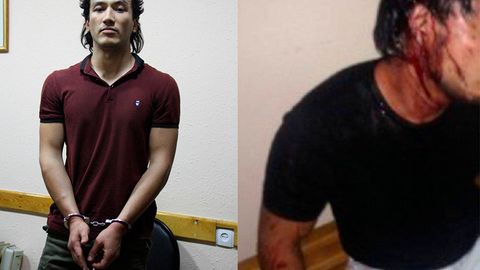 Toshkent shahar IIBB bosqinchilikda gumon qilingan shaxslarga kuch ishlatilgani haqidagi xabarlarni rad etdi