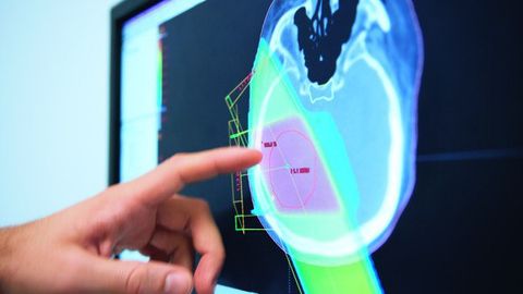 Toshkent viloyatida 5—7-oktabr kunlari Markaziy Osiyo radioonkologiya kongressi bo‘lib o‘tadi