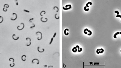 Россиялик олимлар Олтойда «Марс микроблари»нинг янги турини топди
