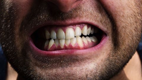 Olimlar tish tozalovchi iplarning xavfli jihatini aniqladi