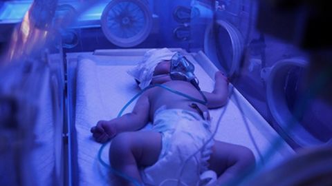 Ироқлик аёл дунёга келтирган 7 эгизак вафот этди