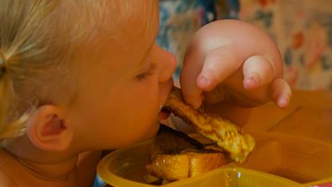 AQShda bahaybat qo‘lli qizchaga liposaksiya yordam berdi