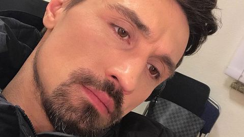 Dima Bilan oyog‘ini ikki joyidan sindirib oldi