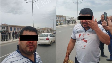 Qarshidagi reydda Spark haydovchisining og‘zi-burni qon bo‘ldi. Transport boshqarmasi haydovchi o‘ziga o‘zi jarohat yetkazganini ta’kidlamoqda