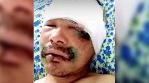 Tuvalik erkak o‘ziga hamla qilgan ayiqning tilini uzib oldi