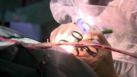 Fransiyada jarroh 30 yil davomida 200 dan ortiq bolalarni zo‘rlagani ma’lum bo‘ldi