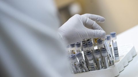 Олимлар коронавирус саккиз баравар хавфлироқ бўлганини маълум қилди