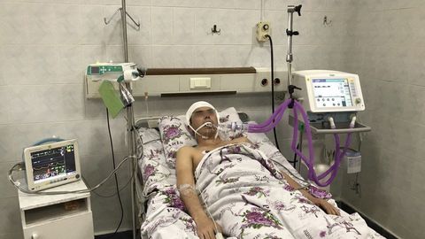 Toshkentda xonadonga chaqirilgan tez tibbiy yordam shifokoriga bemor tomonidan og‘ir tan jarohati yetkazildi